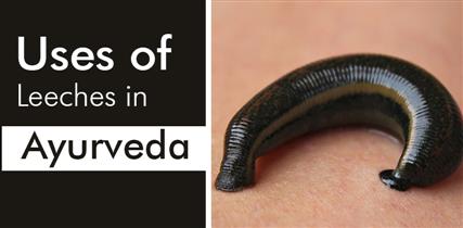 JALAUKA VIDHI: Use of Leeches in Ayurveda